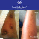Rejuvaskin Scar Esthetique Scar Cream with Silicone - 23 Effective Ingredients - Improves New and Old Scars - 10mL